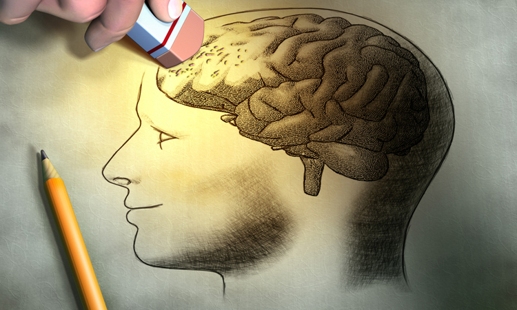 When It Comes to Your Brain, Shrinkage Can Be Good
